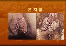 성인성 질환과 에이즈 9페이지