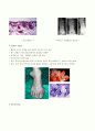 수술실 TKR 케이스 스터디 5페이지