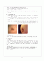 유방암 (breast cancer)에 대해  2페이지