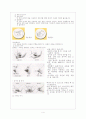 유방염 mastitis 4페이지