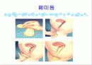 피임 선택이 아니라 필수입니다 (파워포인트) 14페이지