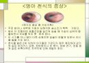 영아 천식 6페이지