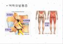 요통재활 간호 파워포인트 5페이지