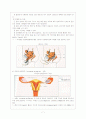 [여성학]피임의 종류와 특징 및 정확한 사용법 7페이지