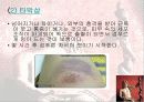 운동상해 10페이지