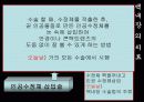 백내장 발표PPT 21페이지