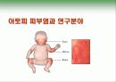 아토피 피부염 (면역학적 관점) 20페이지