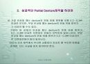 Dentech Positioner System을 이용한 Removable Partial denture 제작. 6페이지