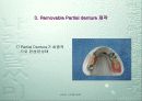 Dentech Positioner System을 이용한 Removable Partial denture 제작. 46페이지
