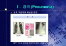 폐렴의 문헌고찰과 간호과정 3페이지