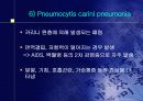 폐렴의 문헌고찰과 간호과정 15페이지