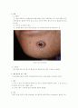 피부암에 대한 정리 3페이지