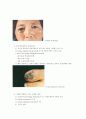 피부암에 대한 정리 11페이지