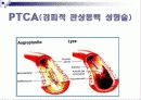 심근경색 31페이지