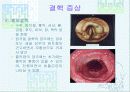 법정 전염병에 대해 74페이지