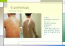 견관절과 견갑대 파워포인트 20페이지