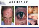 오존층 파괴의 원인과 피해상황 그리고 대책 발표자료 12페이지