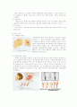 간호학 뇌경색 케이스 12페이지