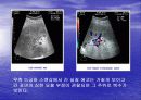 CHEST 질환 및 진단 23페이지