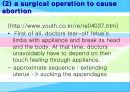 abortion에 대한 찬반 논쟁 4페이지