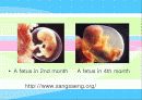 abortion에 대한 찬반 논쟁 22페이지