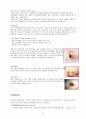 유방암(breast cancer)의 원인과 진단검사 및 치료와 간호  11페이지