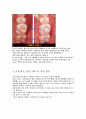 충치(진행, 예방과 치료, 보철 또는 충치 치료 후 시린 경우) 5페이지