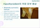 내분비성 피부질환(Endocrine dermatopathy )과 갑상선기능저하증(Hypothyroidism),Hyperadrenocorticism(Cushing's syndrome) 에 관한 발표자료//특A급 수의대생들이 직접제작 11페이지