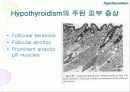 내분비성 피부질환(Endocrine dermatopathy )과 갑상선기능저하증(Hypothyroidism),Hyperadrenocorticism(Cushing's syndrome) 에 관한 발표자료//특A급 수의대생들이 직접제작 13페이지