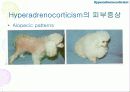 내분비성 피부질환(Endocrine dermatopathy )과 갑상선기능저하증(Hypothyroidism),Hyperadrenocorticism(Cushing's syndrome) 에 관한 발표자료//특A급 수의대생들이 직접제작 24페이지
