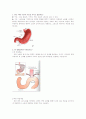 위 절제술 후 환자 식이 1페이지