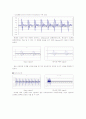 DSP Interpolation and decimation 11페이지