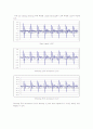 DSP Interpolation and decimation 17페이지