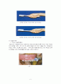 구강건강과 건강관리(올바른잇솔질) 6페이지