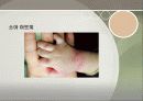아토피에 대하여(환경질환 아토피) 30페이지