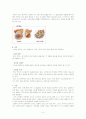 난소낭종 (문헌고찰, 간호과정, 각종검사) 4페이지