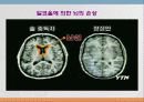 향정신성 약물(마약류)에대한 고찰 12페이지