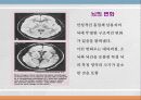 향정신성 약물(마약류)에대한 고찰 16페이지