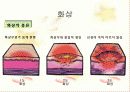 응급처치 교육 14페이지