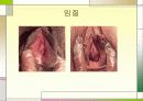 성병에 관한 정리와 이해 15페이지