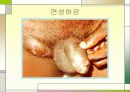 성병에 관한 정리와 이해 22페이지