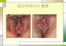 성병에 관한 정리와 이해 26페이지