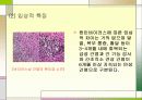 간염에 관한 정리 분석 5페이지