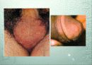 성병(Sexually Transmitted Diseases) 25페이지
