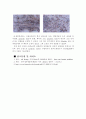 apoptosis(세포죽음) 10페이지
