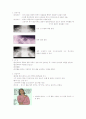 쇄골골절(Clavicle Fracture) 2페이지