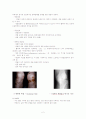 관절염의 종류와 간호 2페이지