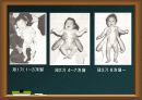 보이타의 7가지 자세반응 검사 방법 16페이지