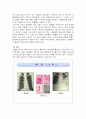 폐렴 케이스 (아동) 4페이지
