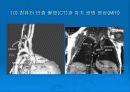 협심증환자간호 29페이지